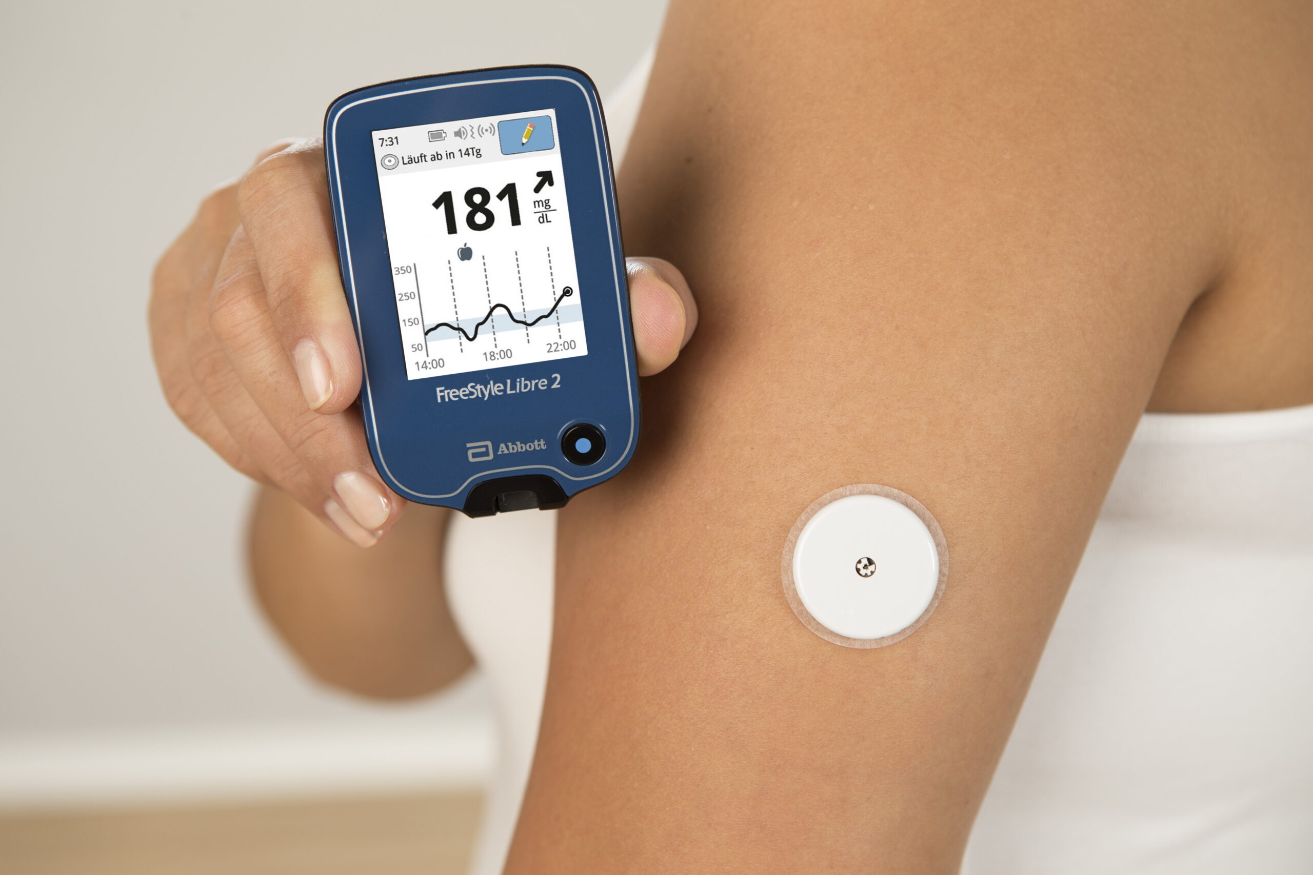 Датчик сенсор системы мониторинга глюкозы: Новая эра самоконтроля для диабетиков